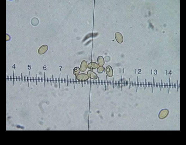 Le Conocybe printanier : spores ©photo O. Lussiana