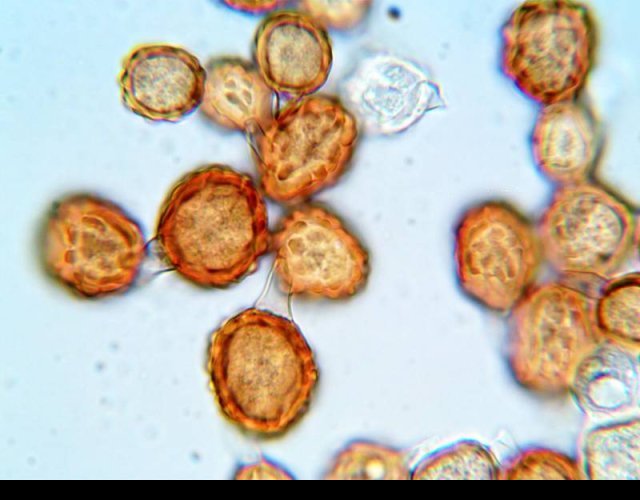 Téleutospores de Uromyces scutellatus ©Photo Ph. Pellicier