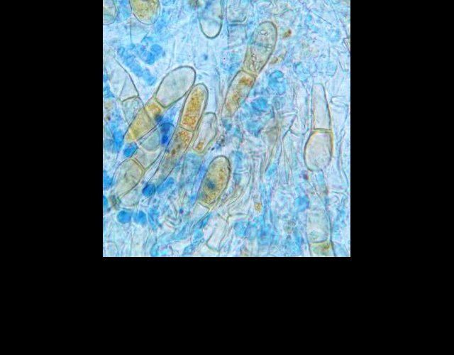 Gymnosporangium clavariiforme, téleutospores au microscope ©photo P. Pellicier