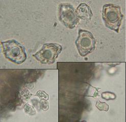 <p>Entoloma hirtipes, mircoscopie : en bas basides X 400 et en haut spores X 1000</p>