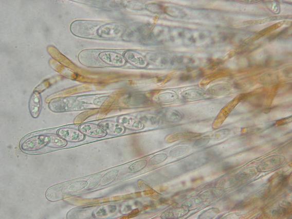 <p>Asques avec leurs ascospores, paraphyses. On peut nettement observer la pigmentation des paraphyses.</p>Photo Ph. Pellicier