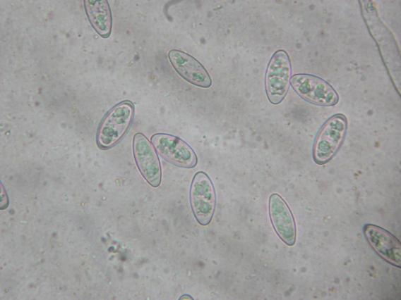 <p>Ascospores X400 avec leur contenu guttulé.</p>Photo Ph. Pellicier