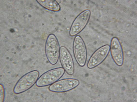 <p>Ascospores X1000</p>Photo Ph. Pellicier
