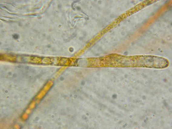 <p>Détail sur l'extrémité d'une paraphyse</p>Photo Ph. Pellicier
