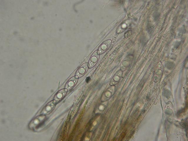 <p>Gyromitra accumbens : asques X 400</p>